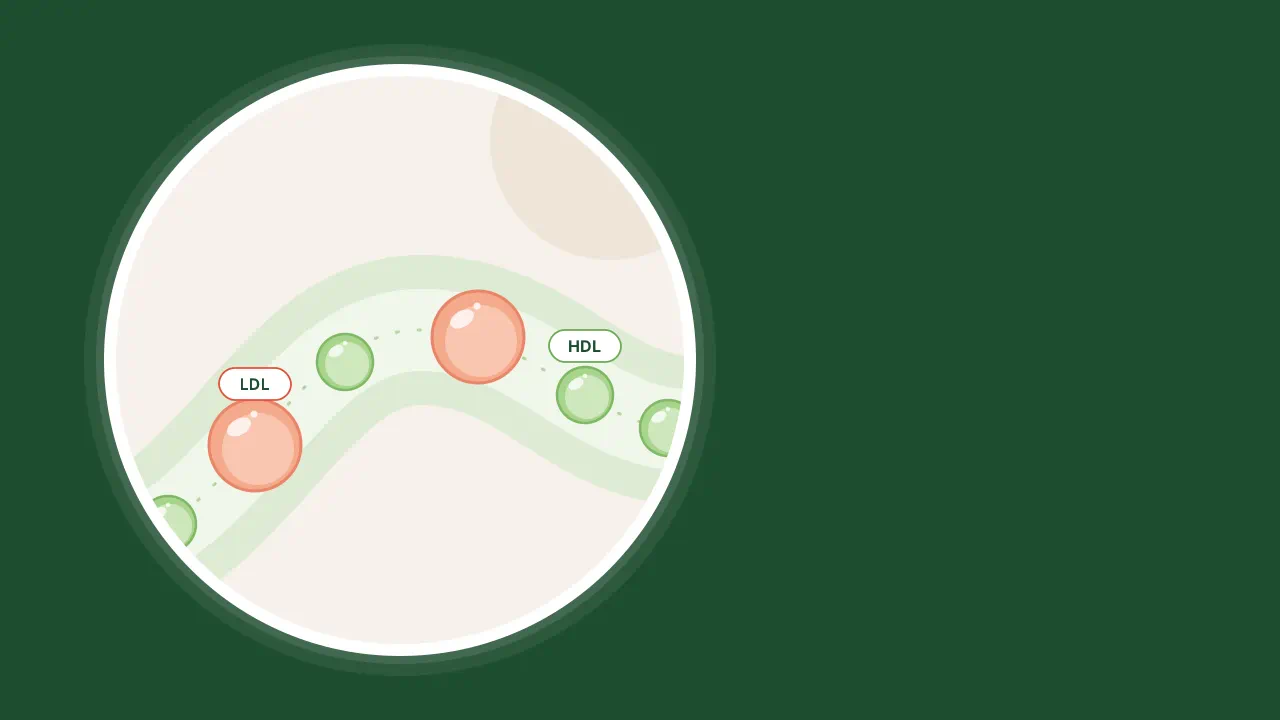 Article, What Causes High Cholesterol?