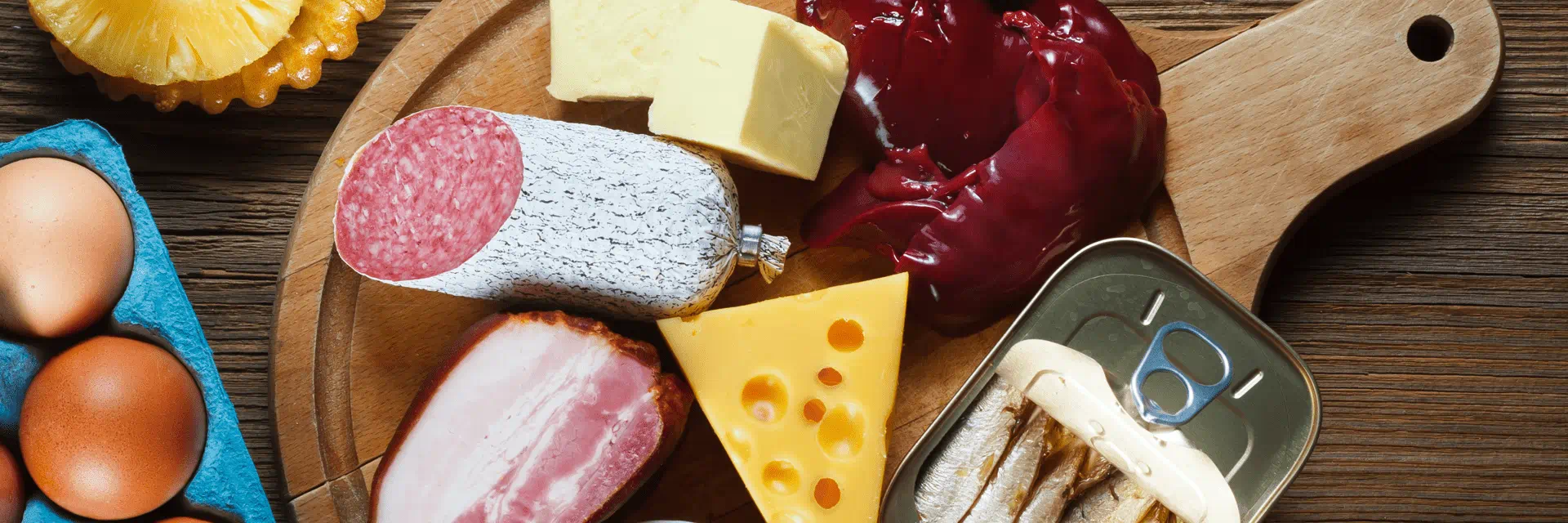 Cholestérol et fromage